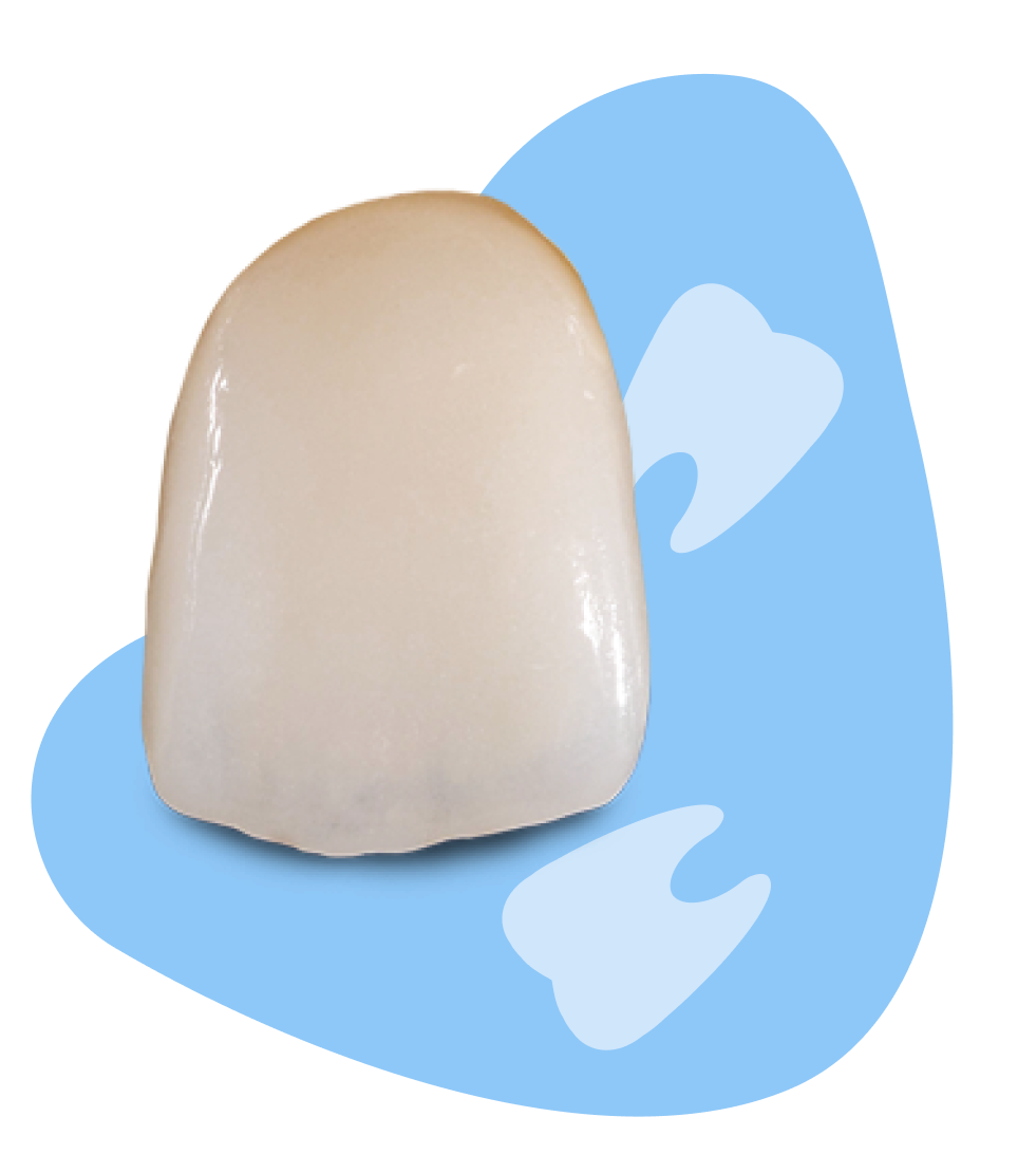veneers