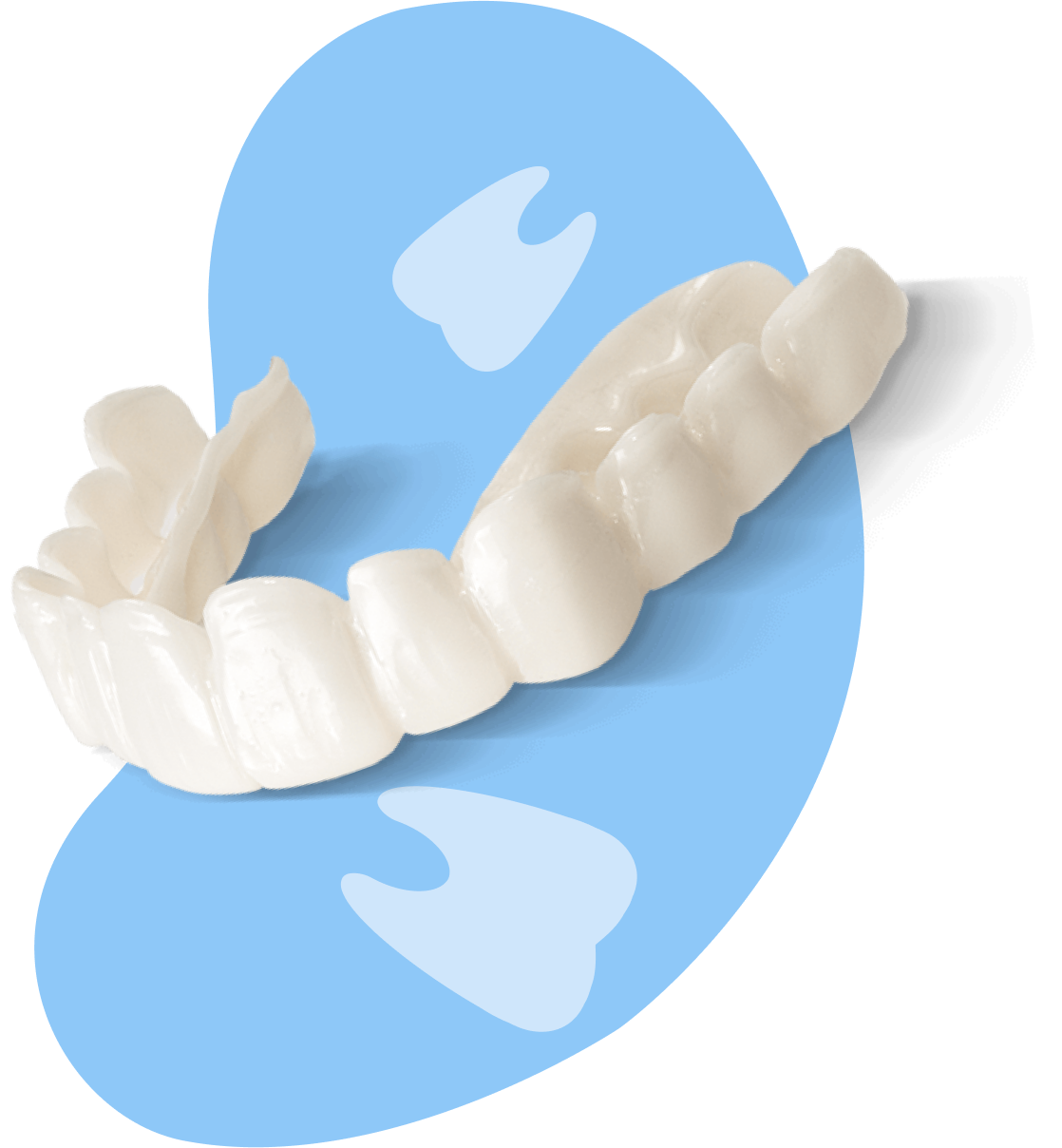 veneers