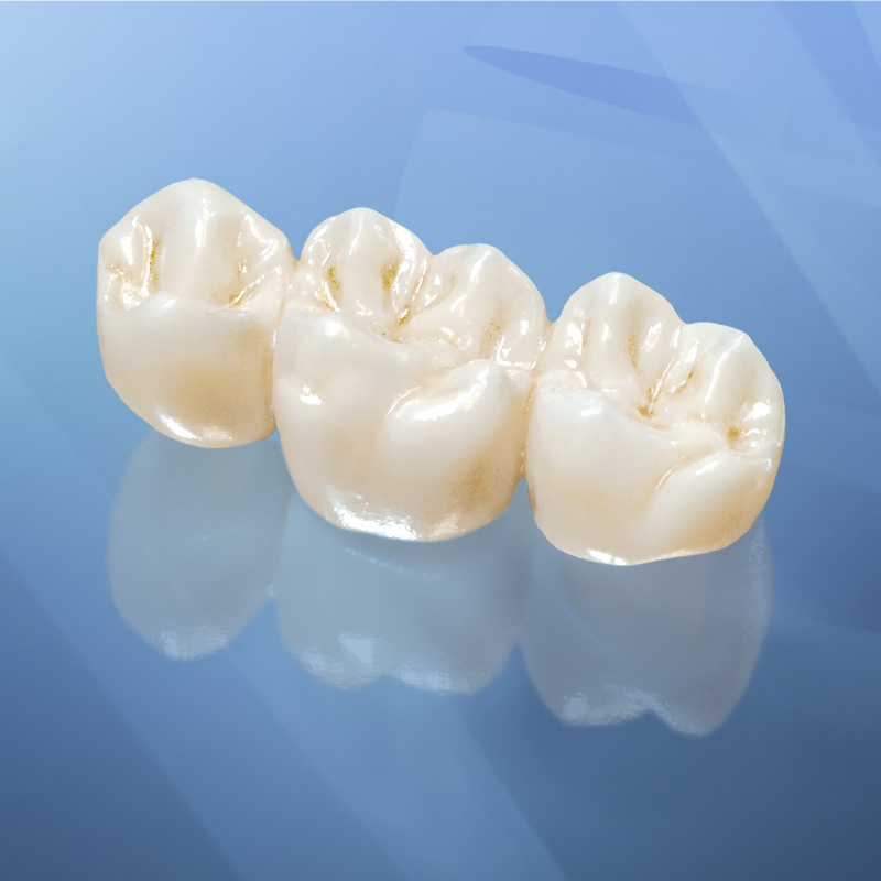 Zirconia vs Porcelain Veneer Radiant Dental Design